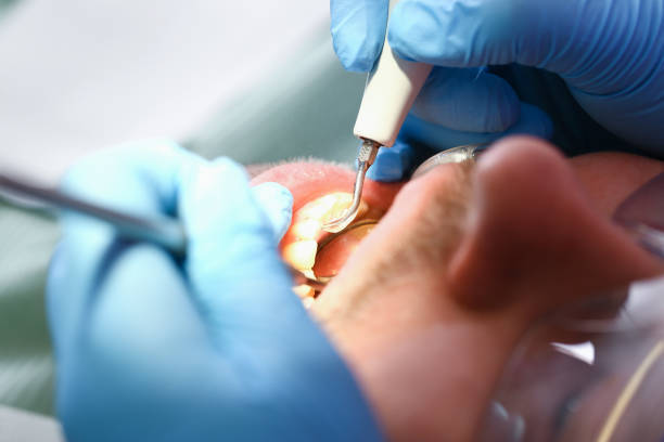 Best Cracked Tooth Emergency Dentist  in National City, CA